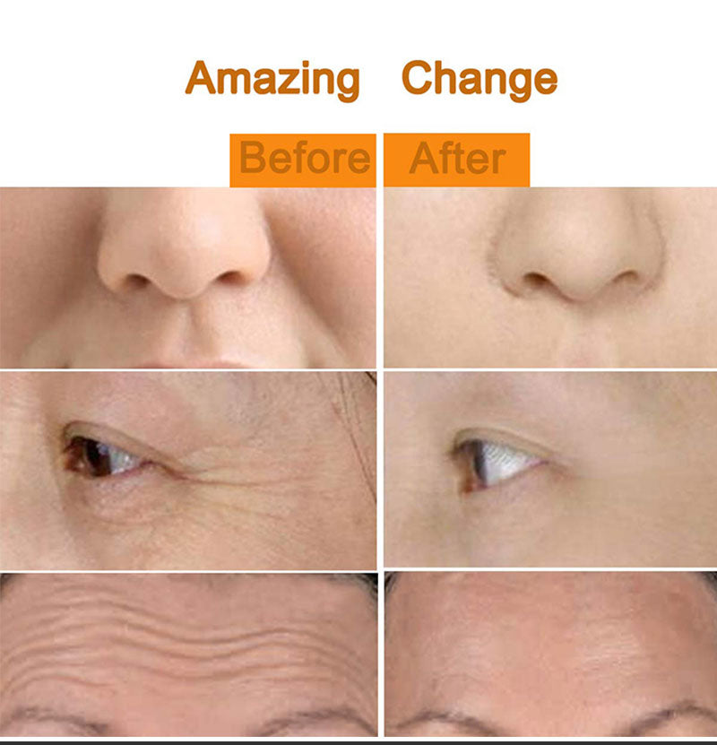 Massaging Roller for Facial Firming